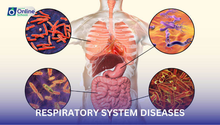 Lesson 07: Respiratory System Diseases
